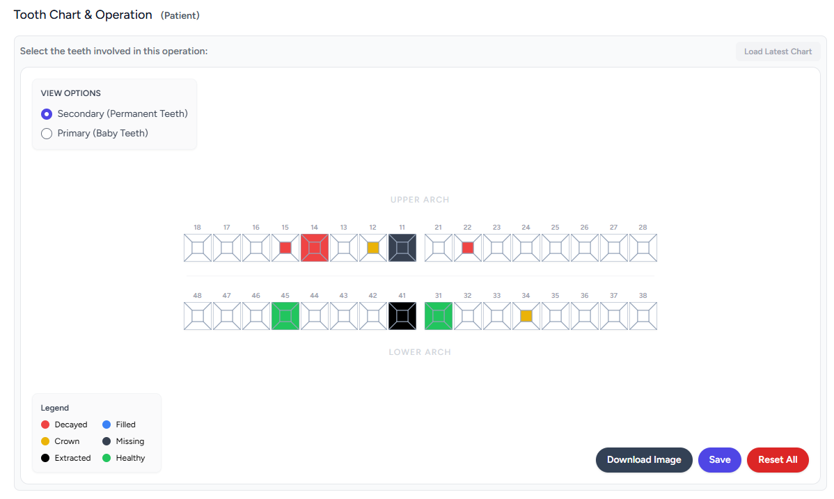 dent-os interactive dental tooth chart